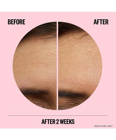 PEACE OUT Skincare Wrinkles: Hyaluronic Acid Microneedling Patches with Retinol, Peptides & Vitamin C - 6 Patches - Buy Online on GoSupps.com