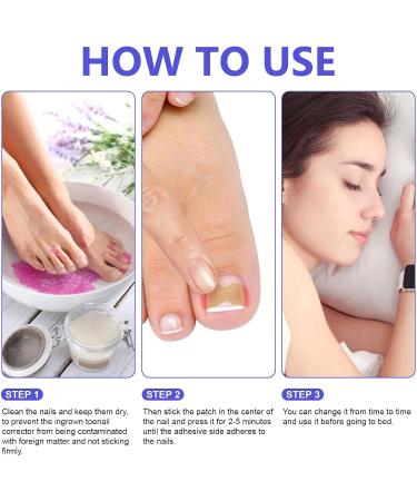 Toen il Correction Sticker 100Pcs: N il Repair P tches Restores Appearance of Discolored or Damaged Nails Foot Care - Buy Online on GoSupps.com