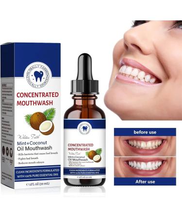 Bain de bouche l'huile de noix de coco fra che - 59 ml - Bain de bouche l'huile de noix de coco pour les dents - Bain de bouche la menthe et la noix de coco - Bain de bouche blanchissant (2) - Buy Online on GoSupps.com