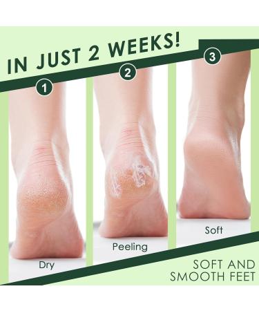2 Paires Masque Pieds Peeling Exfoliant Les Masques Hydratants Pour Les Pied Crevasses Et Pieds Secs Hommes Et Femmes Rendre La Peau Plus Lisse(Alo S + Avocat) - Buy Online on GoSupps.com