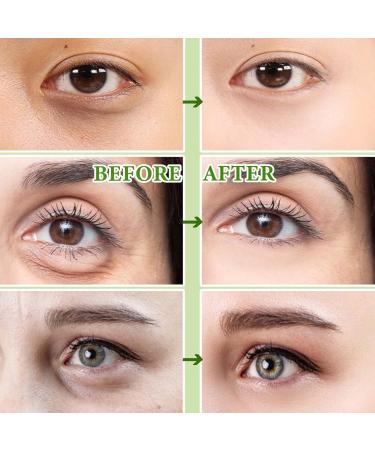 Buy 30 Pairs Gold Eye Mask - Under Eye Patches for Dark Circles Puffiness Relief & Eye Treatment - Smooths Frownies & Reduces Eye Bags | Skin Care Products - Buy Online on GoSupps.com