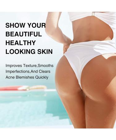 Acne Treatment Cream for Butt & Thigh - Removes Pimples, Ingrown Hairs - Spot & Cystic Acne Treatment - Moisturizes and Repairs Skin - Buy Online on GoSupps.com