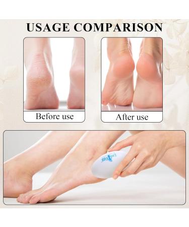 Bisienya Creative Egg Foot Grinder Comes with 1 Nail Clipper Portable Egg Callus Remover Suitable for Removing Dead Skin Egg Shaped Foot Grinder Suitable for Foot spa Home Salon(White) - Buy Online on GoSupps.com