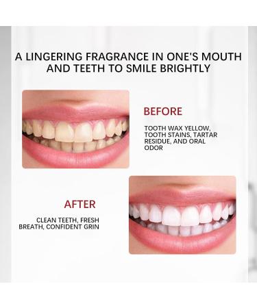 SP-4 Probiotics Whitening Toothpaste - Brightening & Fresh Breath Deep Cleaning Dental Care (1PC) - Shop Internationally - Buy Online on GoSupps.com