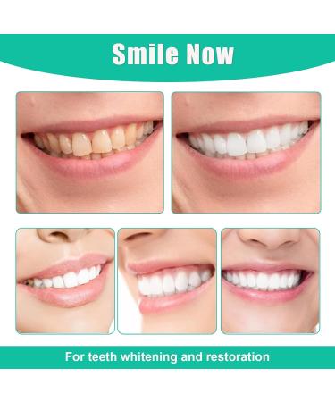 Buy 2 Pairs of Cosmetic Veneers - Temporary Prosthetic Teeth & Lightening Dentures for Men & Women - Instant Smile Makeover - Buy Online on GoSupps.com