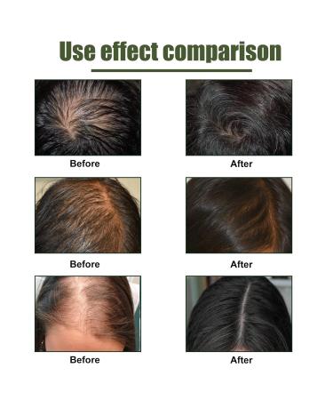 Blusoms FolliGrow Magnesium Hair Growth Serum Spray - Strengthen, Repair Roots, Prevent Hair Loss (3 Pcs) - Buy Online on GoSupps.com