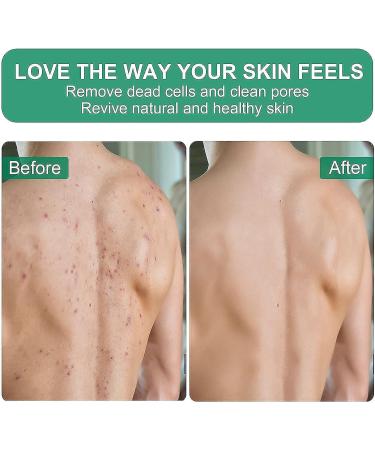 The Kessa Kessa Exfoliating Glove Moroccan Kessa Glove Kessa Glove Shower Glove Moroccan Exfoliating Kessa Glove (5PCS-A) - Buy Online on GoSupps.com