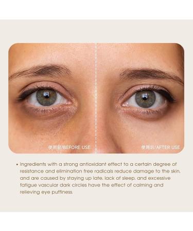 Caffeine Eye Serum Caffeine Solution 5% + EGCG Under Eye Cream for Reduce Circles and Puffy Eyes Caffeine Eye Cream for Anti Aging Wrinkle Eye Bags Removal Fade Fine Lines 30ml*2 - Buy Online on GoSupps.com