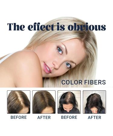 Supersize Color Fibers with Refill Set Colored Hair Thickener Temporary Hair Color for Root Touchup Hair Thickening Fibers Hair Fiber Powder for Women & Men (1 Gold) Gold 1 - Buy Online on GoSupps.com