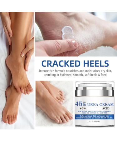 Urea Cream Urea 45% Foot Cream Cracked Heel Repair Cream For Feet and Hand Callus Remover For Dry And Hard Skin Hand Foot and Body 50g - Buy Online on GoSupps.com