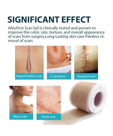 Silicone Scar Tape (1.6 x 120 Roll) - Medical Silicone Sheets for Scar Removal - Keloids, Tummy Tuck, C-Section, Acne, Burn - 7-8 Month Supply - Buy Online on GoSupps.com