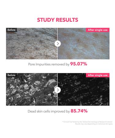 APRILSKIN TXA Niacinamide 99 Pore Care Pink Bubble Gum Deep Cleanser | 99% High-Purity TXA+Niacinamide | All-in-One Cleanser: Deep Cleansing Blackhead Care Pore Care Moisturizing | 4.23 fl.oz. - Buy Online on GoSupps.com