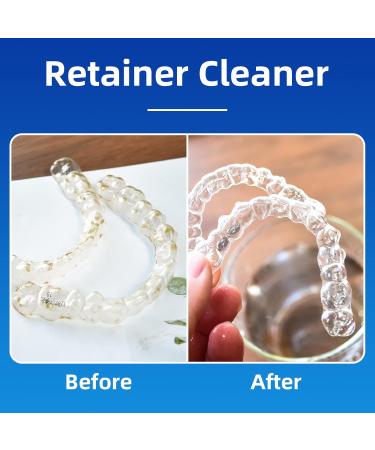 PROJECT BETTER Retainer Cleaner Tablets & Denture Cleaning Tablets for Dental Appliances and Night & Mouth Guard.(186 tablets) - Buy Online on GoSupps.com