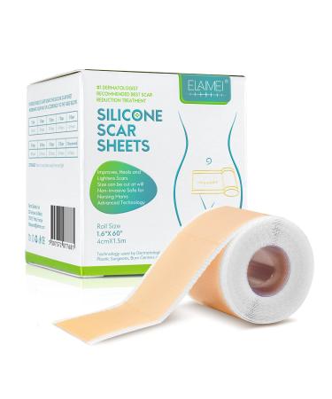 WUHEMA Silicone scar paper medical silicone scar tape roll easy to tear soft silicone tape for removing scars reusable painless silicone film for surgical scars caesarean section burns Keloid