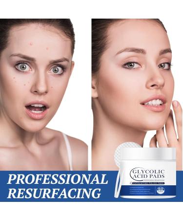 Glycolic Acid Resurfacing Pads (60 Count) - 10% Ultra Pure Glycolic Acid + 2% Salicylic Acid Radiant Skin Renewal & Peeling Pads for Face 60 Count (Pack of 1) - Buy Online on GoSupps.com