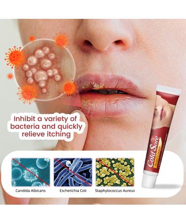 RedOceansM Labial repair gel for the lips helps soothe stinging and burning sensations on the lips immediate fresh effect optimal skin tolerability 20 g - Buy Online on GoSupps.com