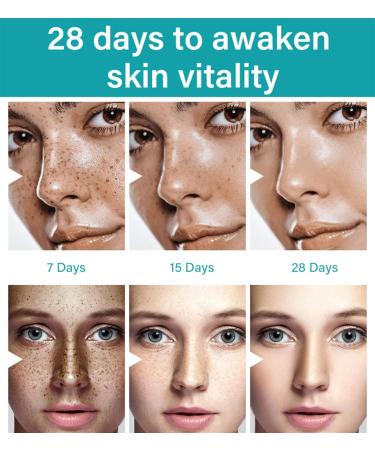 Skin Whitening Cream | Armpit & Underarm Lightening | Dark Spot Corrector for Body | 2oz Intimate Area Bleaching Solution - Buy Online on GoSupps.com