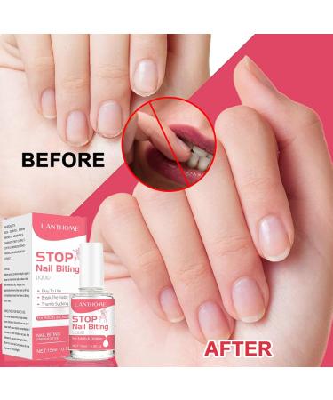 Anti Nail Biting Polish - Stop Biting Nails - Nail Biting Prevention - Stop Nail Repair Clear Varnish - Discourages Nail Biting and Thumb Sucking For Children and Adults - Buy Online on GoSupps.com
