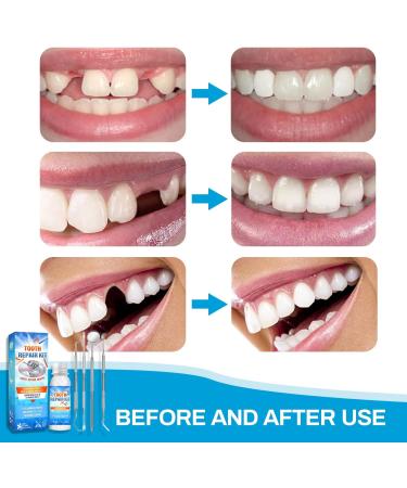 Buy Temporary Dental Replacement Products | Denture Sets Adhesives & DIY Vampire Fake Dentures - International Shipping - Buy Online on GoSupps.com