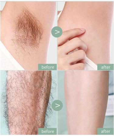 UGIF 3PCs Manual Hair Removal Knife - Painless Bikini & Armpit Trimmer for Women - Portable Face & Full Body Razor - 12cm Pink - Buy Online on GoSupps.com