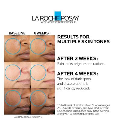 La Roche Posay Glycolic Acid Serum with Kojic Acid and Vitamin B5 | Dark Spot Corrector & Skin Tone Brightener - Buy Online on GoSupps.com