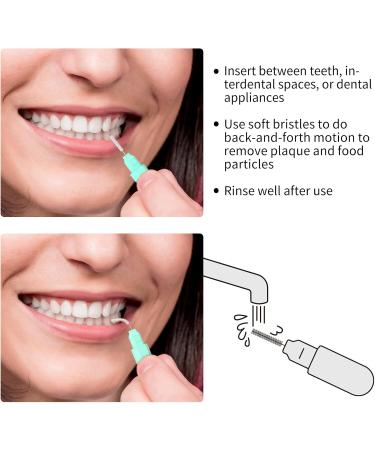 Interdental Brush 1.0 mm - Green | Effective Oral Care for Healthy Teeth & Gums | International Shipping Available - Buy Online on GoSupps.com