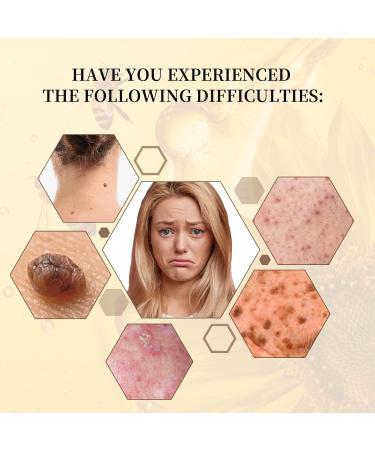 Buy Bee Venom Cream | Repair & Treat Moles & Warts | Professional Skin Correcting Gel for All Skin Types - International Shipping Available - Buy Online on GoSupps.com