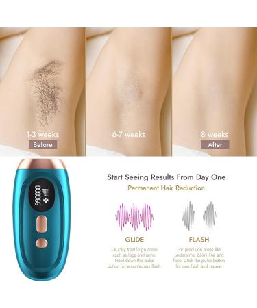 Laser Hair Removal with Cooling System - At-Home IPL Hair Removal for Women & Men - 999,900 Flashes - Permanent Hair Removal Device for Facial, Legs, Arms, Bikini Line - Green - Buy Online on GoSupps.com