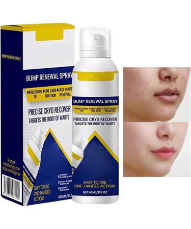  yupeuooe Moisturizing Body Cream - 60 ml Soothing and Repairing Solution Mist | Refreshing and Nourishing Skin Spray for Men and Women Blemish-Prone Skin Back Shoulders - Buy Online on GoSupps.com