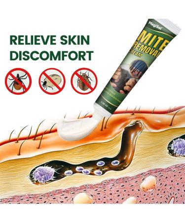  MagiSel Deep Cleansing Cream Scalp Exfoliating Scalp Gentle Care for Itchy Dandruff Hair Care Gentle Moisturizing Moisturizing 30g - Buy Online on GoSupps.com