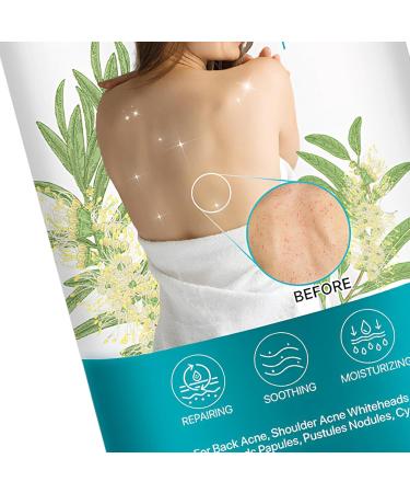 Skin care spray 120 ml liquid for impurities on the back for women men and young people body back arms legs - Buy Online on GoSupps.com