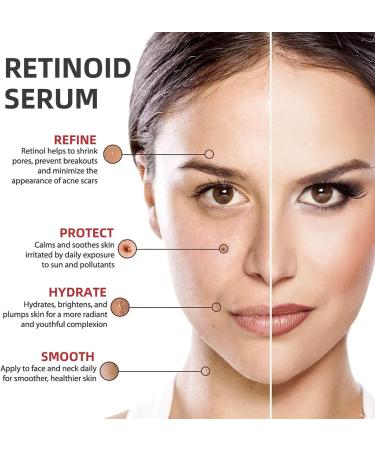 Face Moisturiser Retinoid 2% Emulsion Retinol Serum High Strength for Face Retinol Face Serum Anti Wrinkle Serum Fade Fine Lines Acne Reduced Skin Repair Serum for Women & Men 30ml 1PC Retinoid 2% Emulsion - Buy Online on GoSupps.com