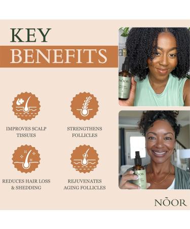 NOOR HAIR Rosemary Growth Spray for Women | Natural Hair Loss Treatment | Thicker Healthier Hair in 8-12 Weeks | Easy Application - Buy Online on GoSupps.com