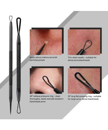 Jolifile 7-Piece Blackhead Removal Set | Acne Comedone Extractor Tools | Blackening Remover & Pimple Popper Tweezers - International Shipping Available - Buy Online on GoSupps.com