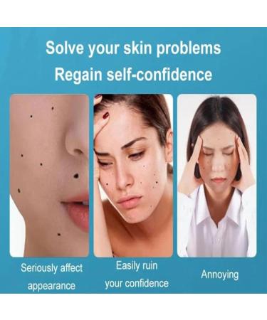 REATIFUL Concentrated Skin Removal Cream - Herbal Formula Ointment for Skin Cleanup (1 set) - Buy Online on GoSupps.com