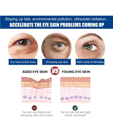 Jasmine Ointment for Dark Circles | Eye Cream with Collagen & Aloe | International Shipping - Buy Online on GoSupps.com