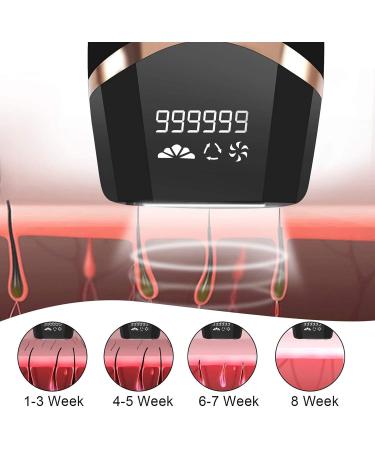 IPL Hair Removal Device - 999 900 Light Impulses Pain-Free 5 Energy Levels for Men & Women - Face Armpits Legs & Body - Buy Online on GoSupps.com