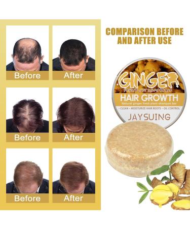 Solid Ginger Shampoo 2pcs Ginger Shampoo Hair Growth Solid Ginger Shampoo Soap Ginger Shampoo Repair Damaged Hair And Promote Hair Growth - Buy Online on GoSupps.com