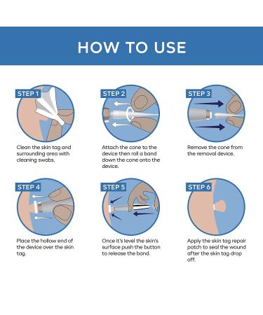 Skin Tag Remover Kit - Easy Application Device for Small to Medium Skin Tags (2mm-5mm) - Blue Kit - Buy Online on GoSupps.com