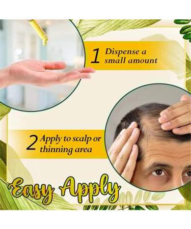  Sinye Hair Growth Serum Essential Oil Fast Hair Growth Treatment Herbal Essential Oil for Hair Loss Rapid Growth 30ml (B) - Buy Online on GoSupps.com