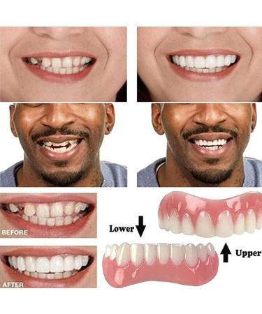 2 Pairs of Cosmetic False Teeth Veneers - Provisional Denture and Artificial Teeth - White Tooth Covers for a Perfect Smile | International Shipping - Buy Online on GoSupps.com