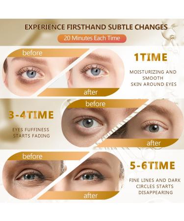 60 Pcs 24K Gold Under Eye Patches 30 Pairs Women Undereye Mask for Puffy Eyes Dark Circles Treatment Beauty Skin Care Products Men Collagen Gel Pads Hydrating for Eye Bags Puffiness Wrinkle - Buy Online on GoSupps.com