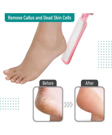 Slick Pink Foot File Callus Remover - Effective Dead Skin Scraper & Heel Grater for Smooth Feet - Buy Online on GoSupps.com