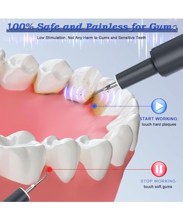 Iriplezo Ultrasound Tartar Remover Tooth Cleaner Set for Dogs & Cats - 5 Adjustable Levels for Effective Tooth Cleaning - Buy Online on GoSupps.com