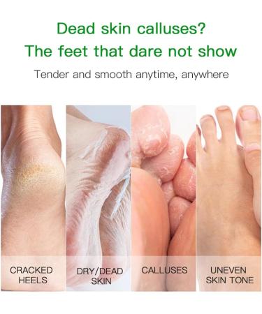 Masques exfoliants pour les pieds | liminateur de callosit s | Hydratant apaisant pour talons fissur s | limine les peaux mortes | Masques de pieds de 320 g | Portable | Hydratant | Pour homme et - Buy Online on GoSupps.com