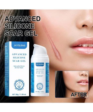 Gomice Scar | Scar Repair Gel for Stretch Marks | Scar Treatment for Surgical Scars Caesarean Sections Cuts & Burns Reduce - Buy Online on GoSupps.com