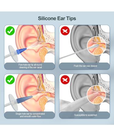 Ultimate Ear Wax Removal Kit | Safe & Effective Ear Cleaner for Adults & Kids | Ear Irrigation System & Candles - Buy Online on GoSupps.com