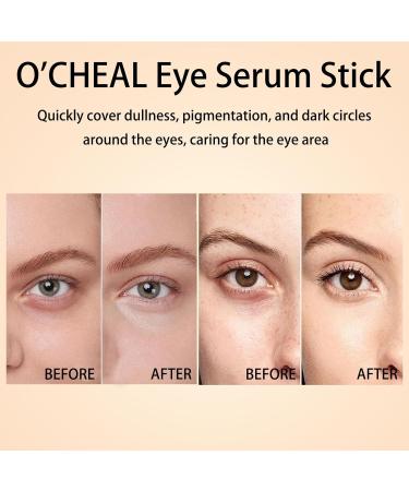 O'CHEAL Eye Serum Stick Hydrating Nourishing Brightens Tightens Reduces Dark Circles & Eyes Pigmentation Improves Dullness Bags Remover Under Eye Cream Lifts and Firms Skin Easy to Absorb - Buy Online on GoSupps.com