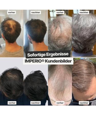 Imperio Scatter Hair - Instant Volume & Authentic Look | 100% Natural Purple Hair | Premium Quality (26g Gray) - Shop Internationally! - Buy Online on GoSupps.com