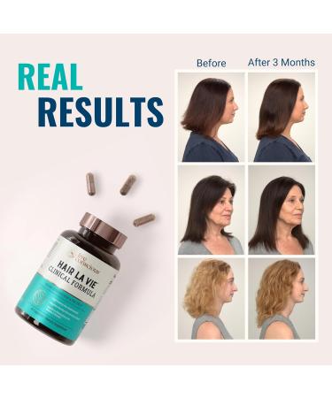Hair La Vie Clinical Formula Hair Vitamins with Biotin and Saw Palmetto - 90 Count for Healthy Hair and Whole-Body Wellness - Buy Online on GoSupps.com